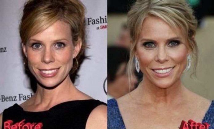 Cheryl Hines Plastic Surgery - Diversity News Magazine