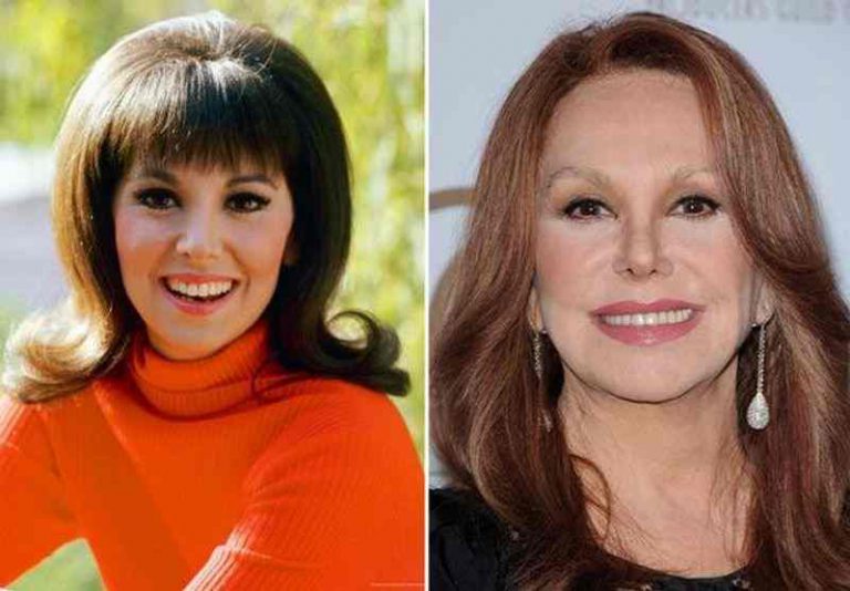 Marlo Thomas Plastic Surgery - Diversity News Magazine