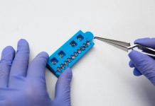 Braces Improve Dental Health