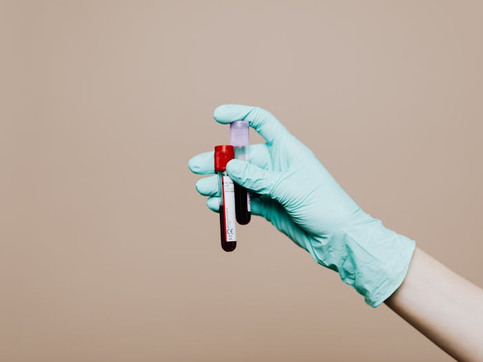 Understanding the CA125 Blood Test: What You Need To Know CA125 Blood Test