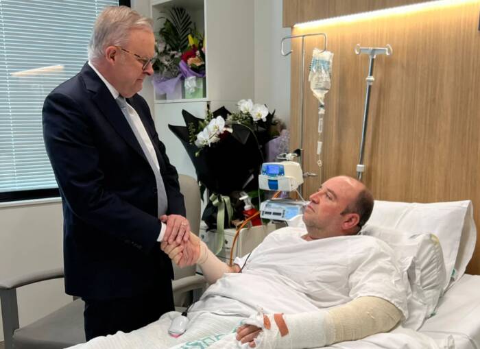‘Best of Our Country’: Australian PM Visits Bondi Hero in Hospital Australian PM Visits Bondi Hero in Hospital